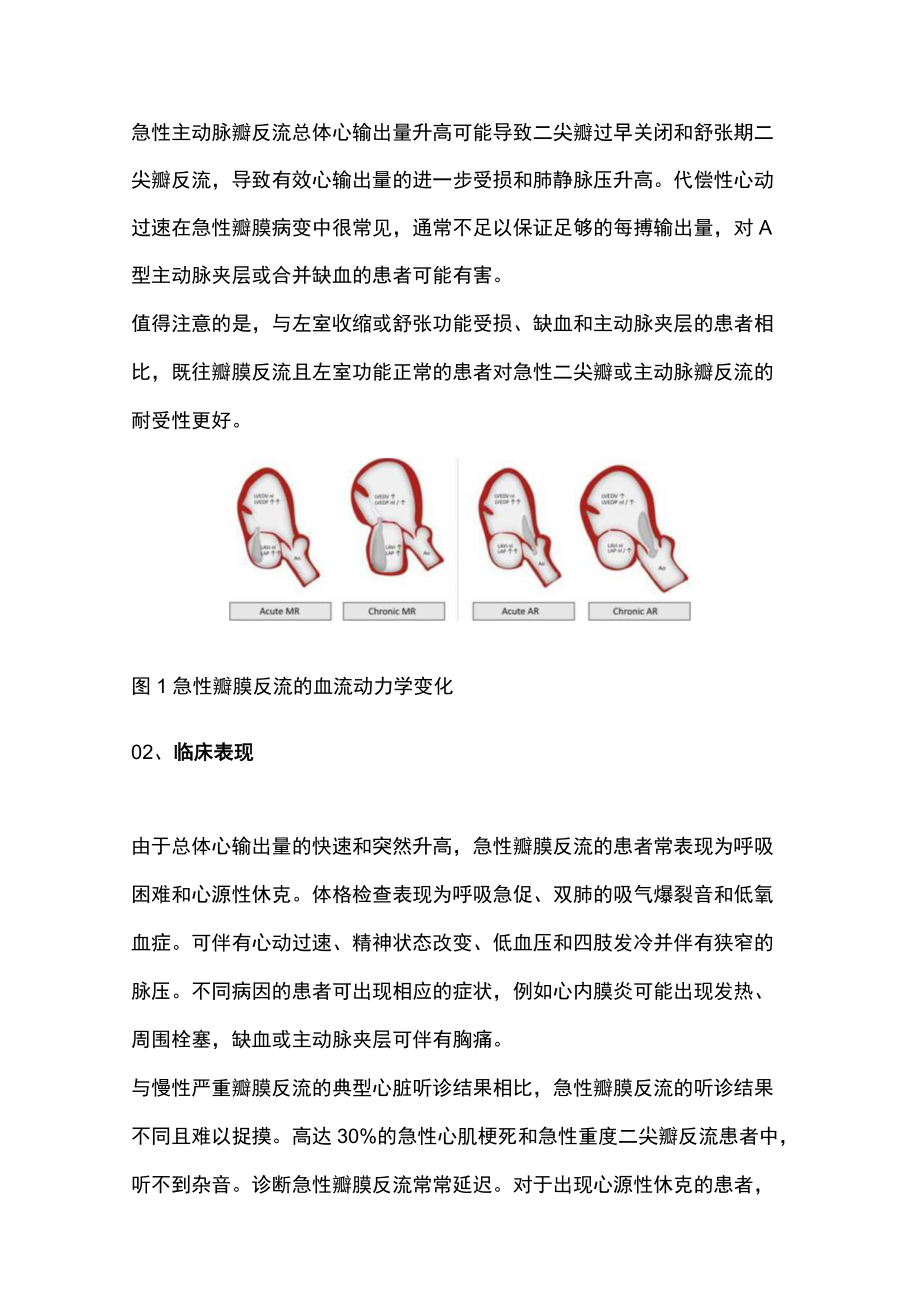 2022急性瓣膜反流的临床管理（全文）.docx_第2页