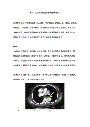 2022主动脉夹层的诊断和治疗（全文）.docx