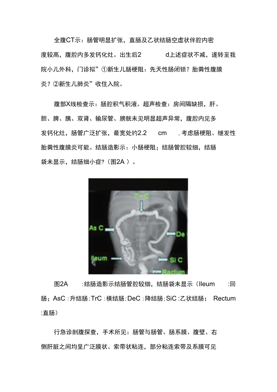 超声科医师晋升副主任（主任）医师例分析专题报告（产前超声诊断胎儿先天性肠闭锁及胎粪性腹膜炎）.docx_第3页