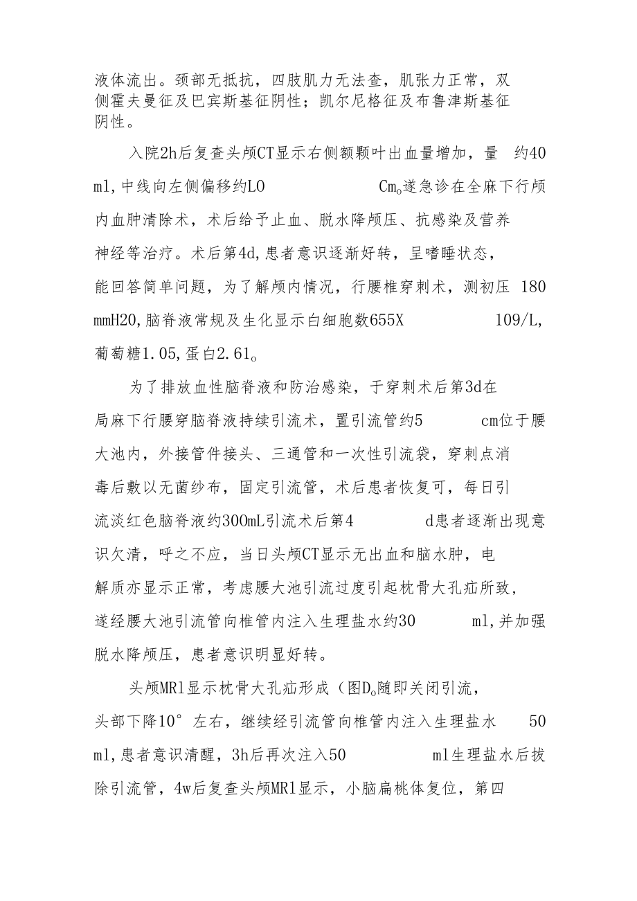 腰大池持续引流术后枕骨大孔疝病例分析专题报告.docx_第2页