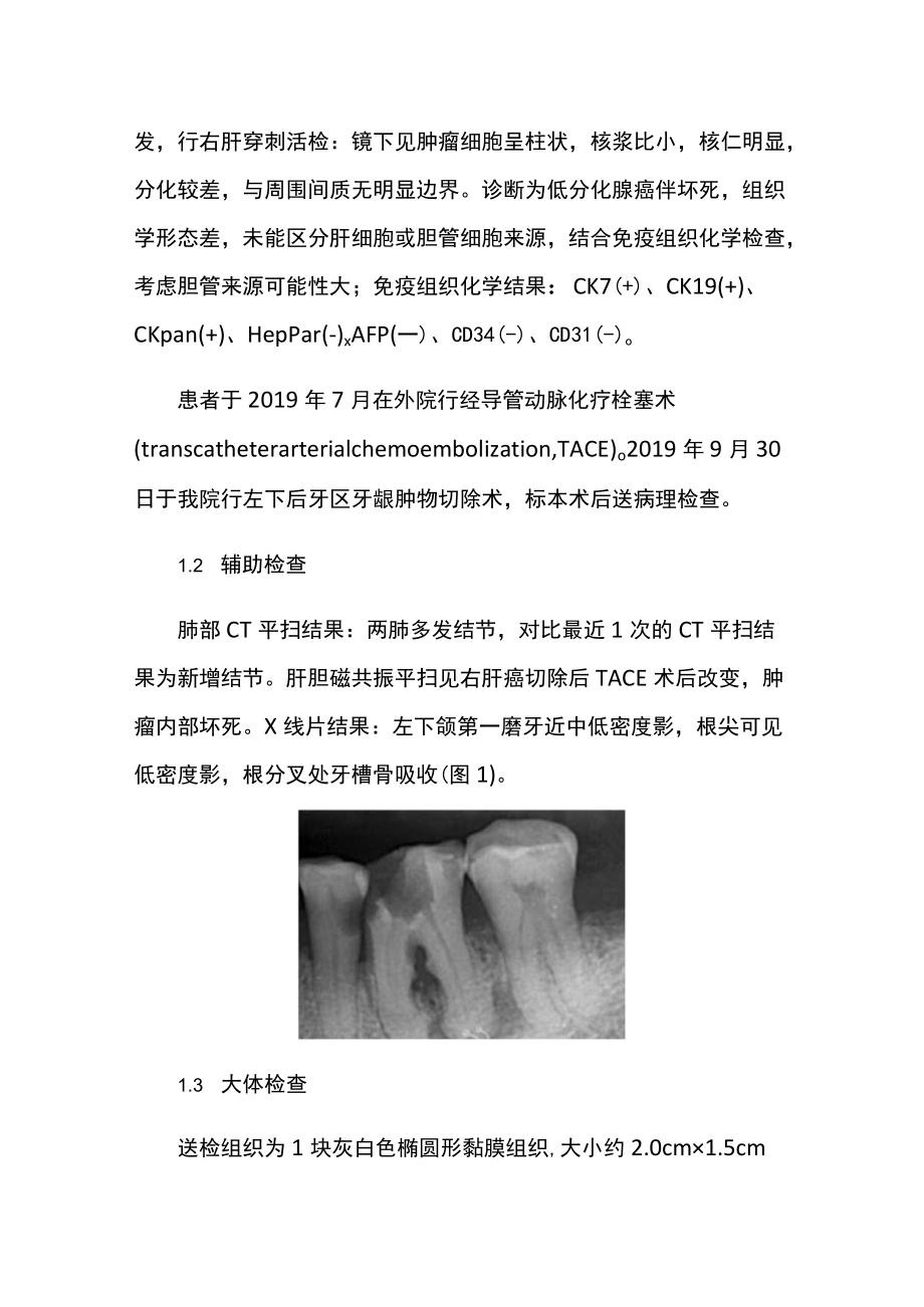 肝内胆管细胞癌牙龈转移病例分析.docx_第2页