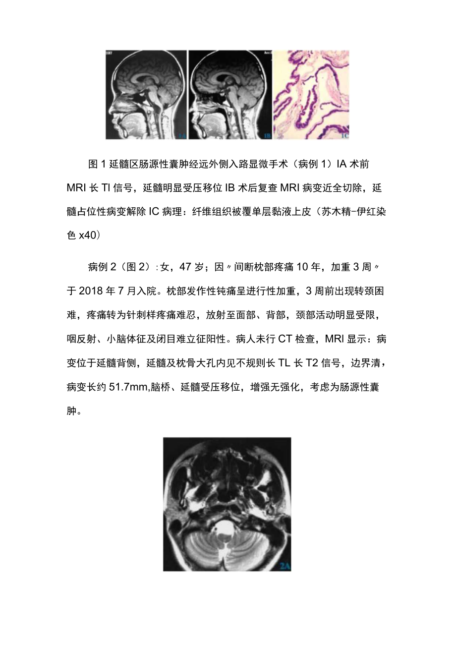 脑外科医师晋升副主任（主任）医师高级职称病例分析专题报告（肠源性囊肿）.docx_第3页