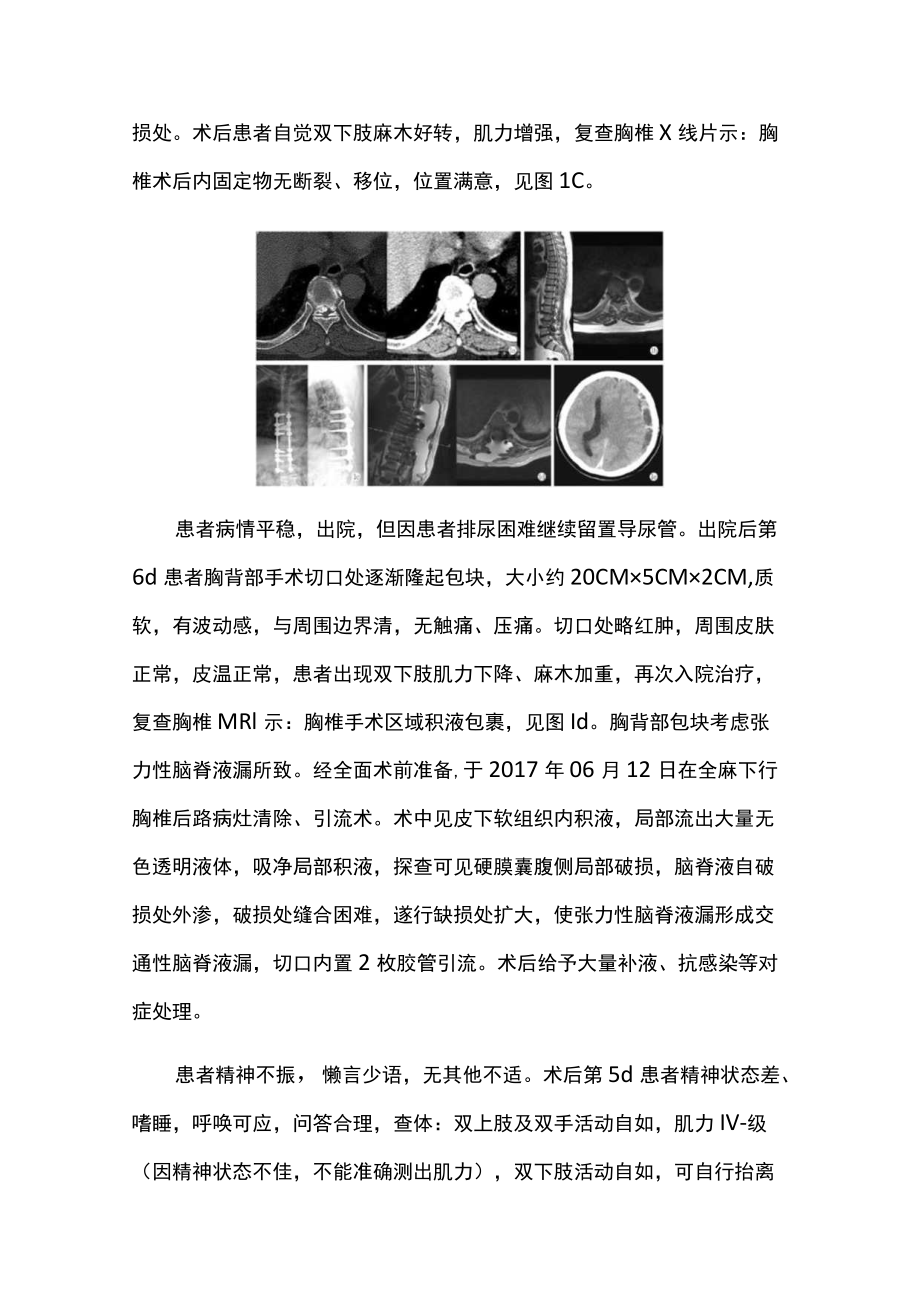 脊柱科医师晋升副主任（主任）医师高级职称病例分析专题报告（胸椎间盘突出症）.docx_第3页