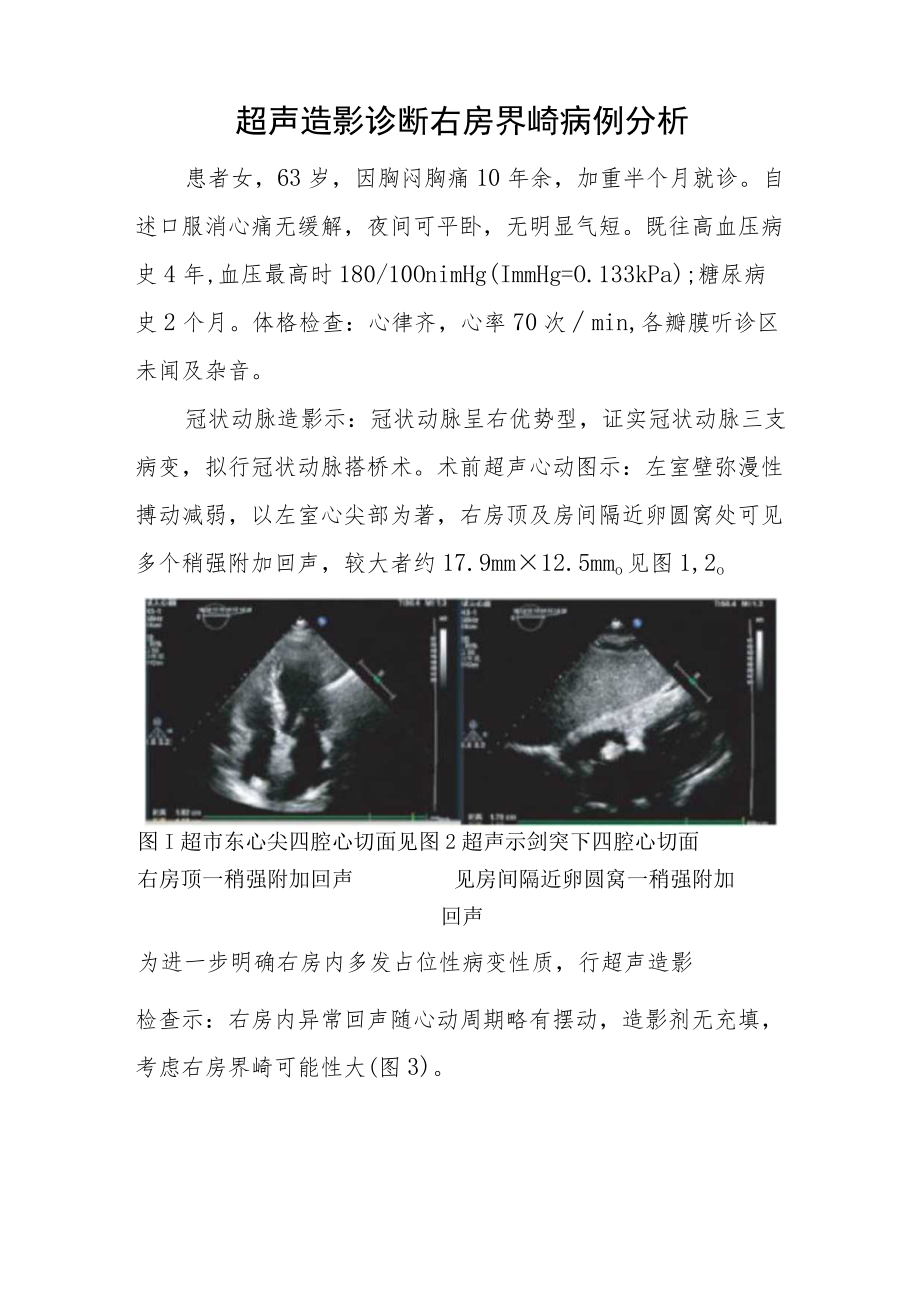 超声科医师（技师）晋升高级职称病例分析专题报告汇编三篇.docx_第2页