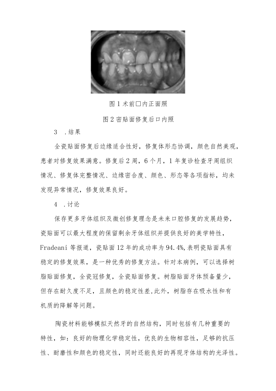 口腔科晋升副主任医师病例高级职称分析专题报告3篇汇编.docx_第3页