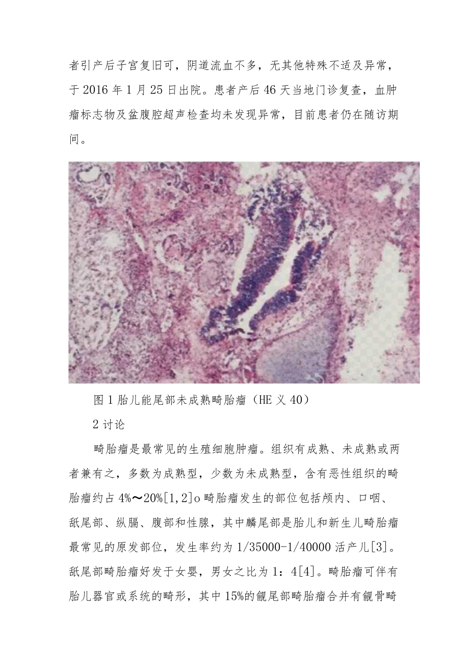 妇产科晋升副主任医师专题报告病例分析汇编3篇.docx_第3页