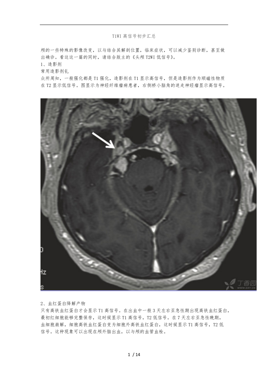 头颅T1WI高信号初步汇总.doc_第1页
