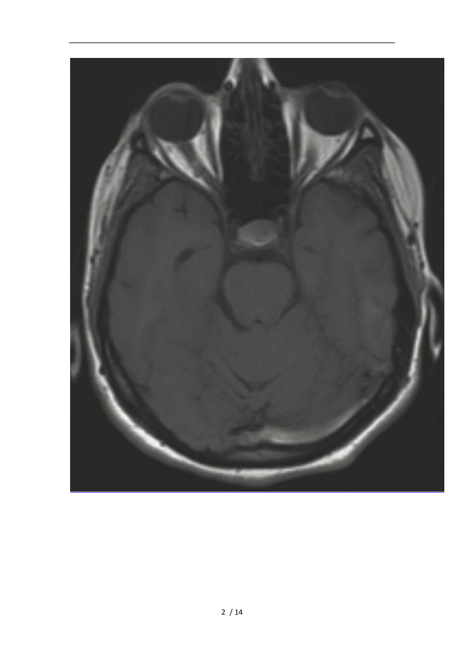 头颅T1WI高信号初步汇总.doc_第2页
