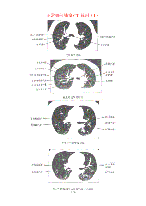 正常胸部CT解剖肺窗和纵隔窗.doc