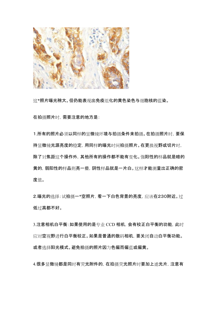 灰度值和光密度值在免疫组化定量分析.docx_第2页