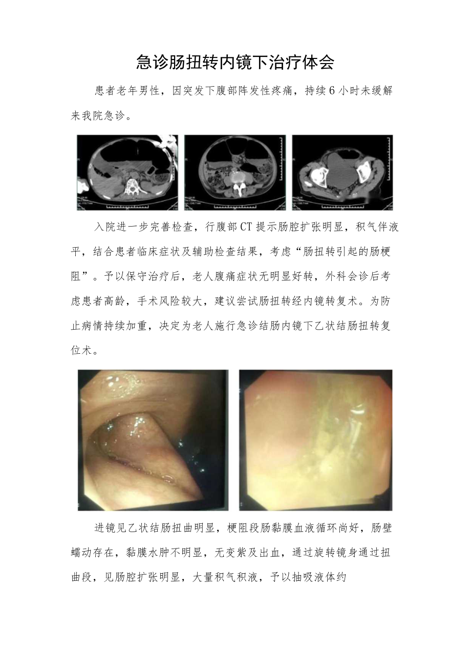 消化内科晋升副主任（主任）医师病例分析专题报告（急诊肠扭转内镜下治疗体会）.docx_第2页