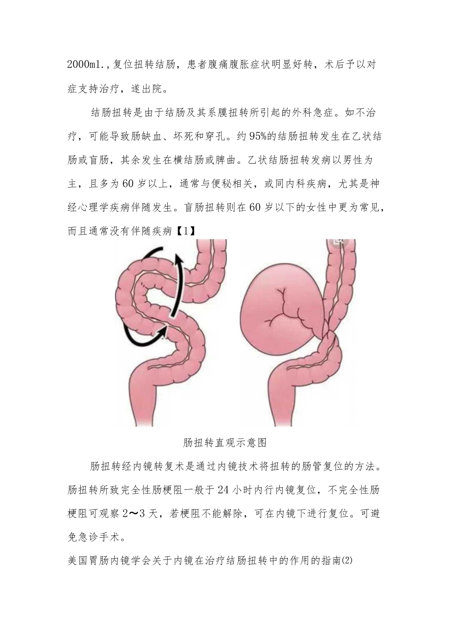 消化内科晋升副主任（主任）医师病例分析专题报告（急诊肠扭转内镜下治疗体会）.docx_第3页