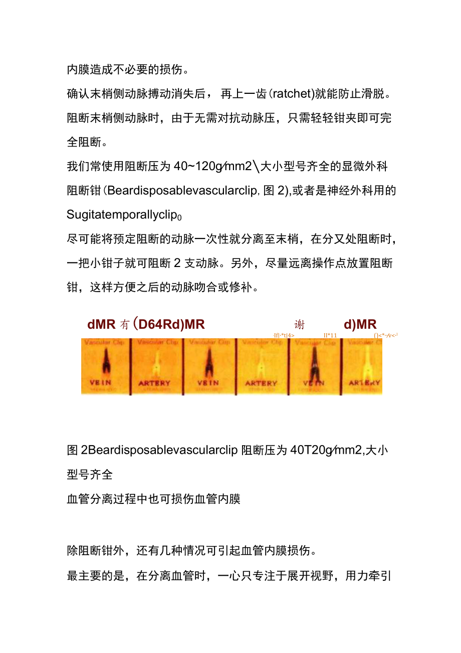 胆道外科中血管内膜损伤预防与血管钳选择.docx_第3页