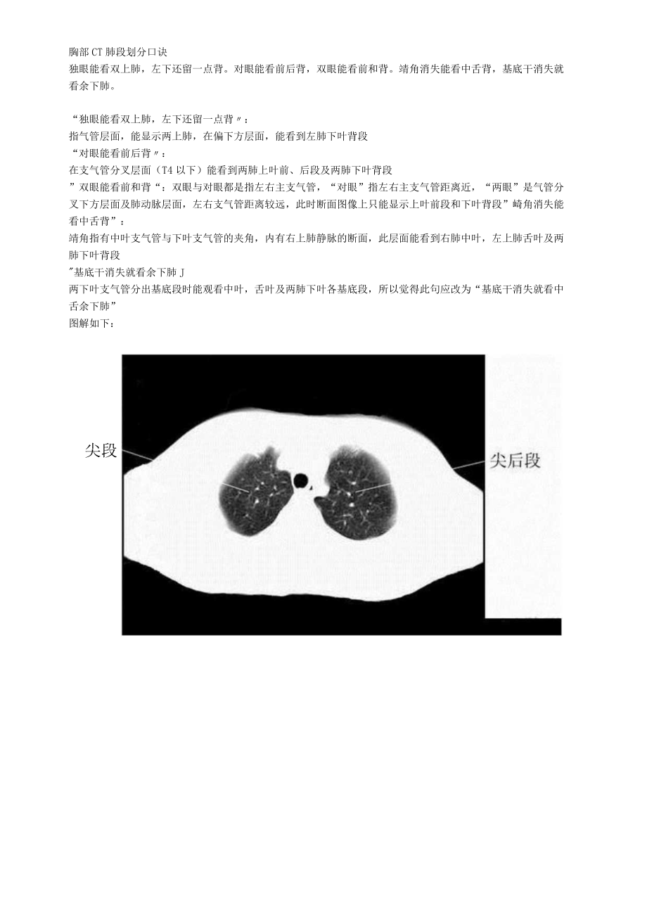 胸部CT肺段划分口诀.docx_第1页