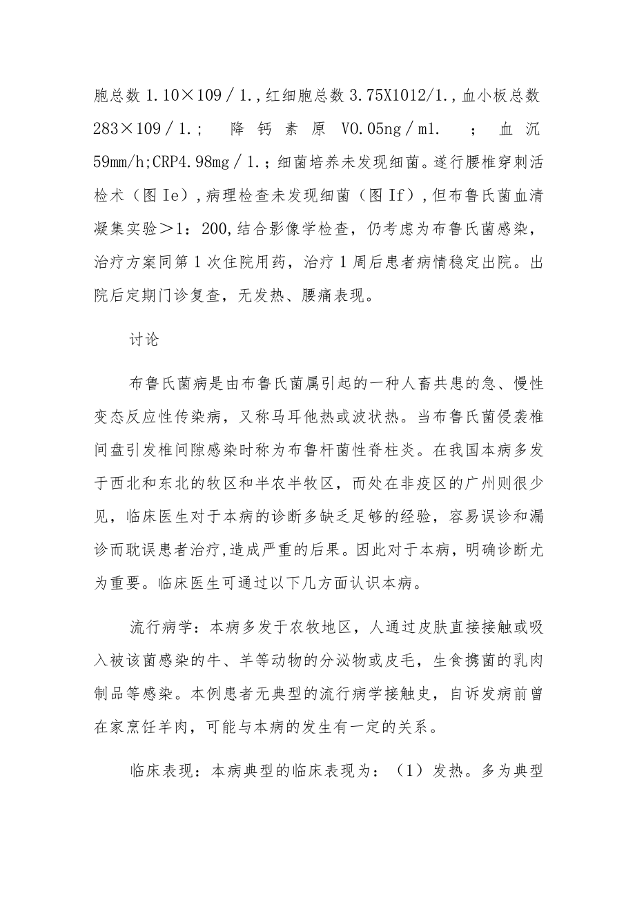 一例马耳他布鲁菌感染性脊柱炎病例分析专题报告.docx_第3页