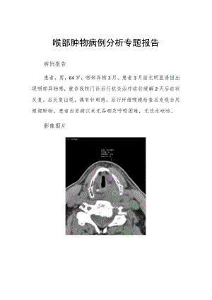 喉部肿物病例分析专题报告.docx