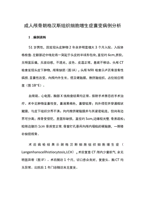 成人颅骨朗格汉斯组织细胞增生症囊变病例分析.docx