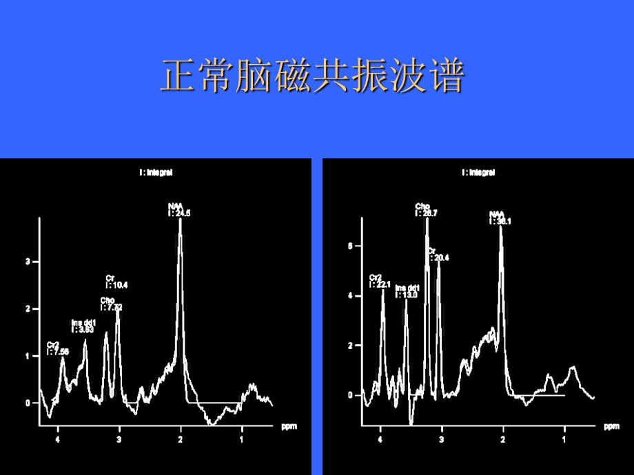 磁共振波谱成像的脑部应用.ppt_第3页