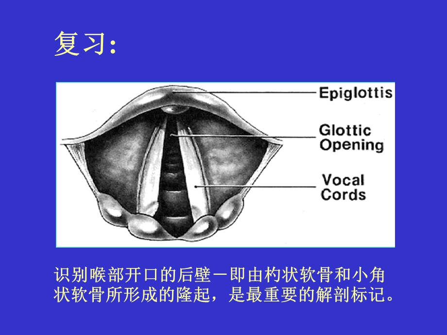 气管插管及困难名师编辑PPT课件.ppt_第2页