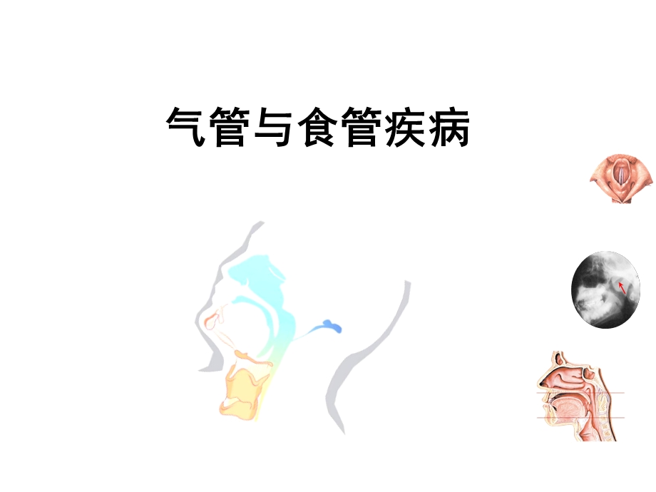 气管与食管疾病名师编辑PPT课件.ppt_第1页