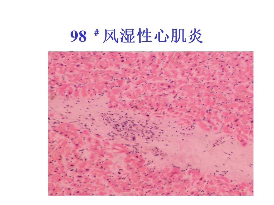 病理学1心血管系统疾病.ppt_第3页