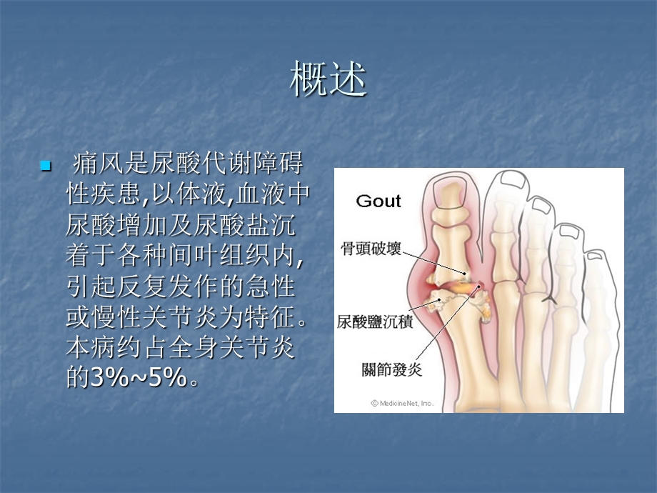 痛风性关节炎.ppt_第2页