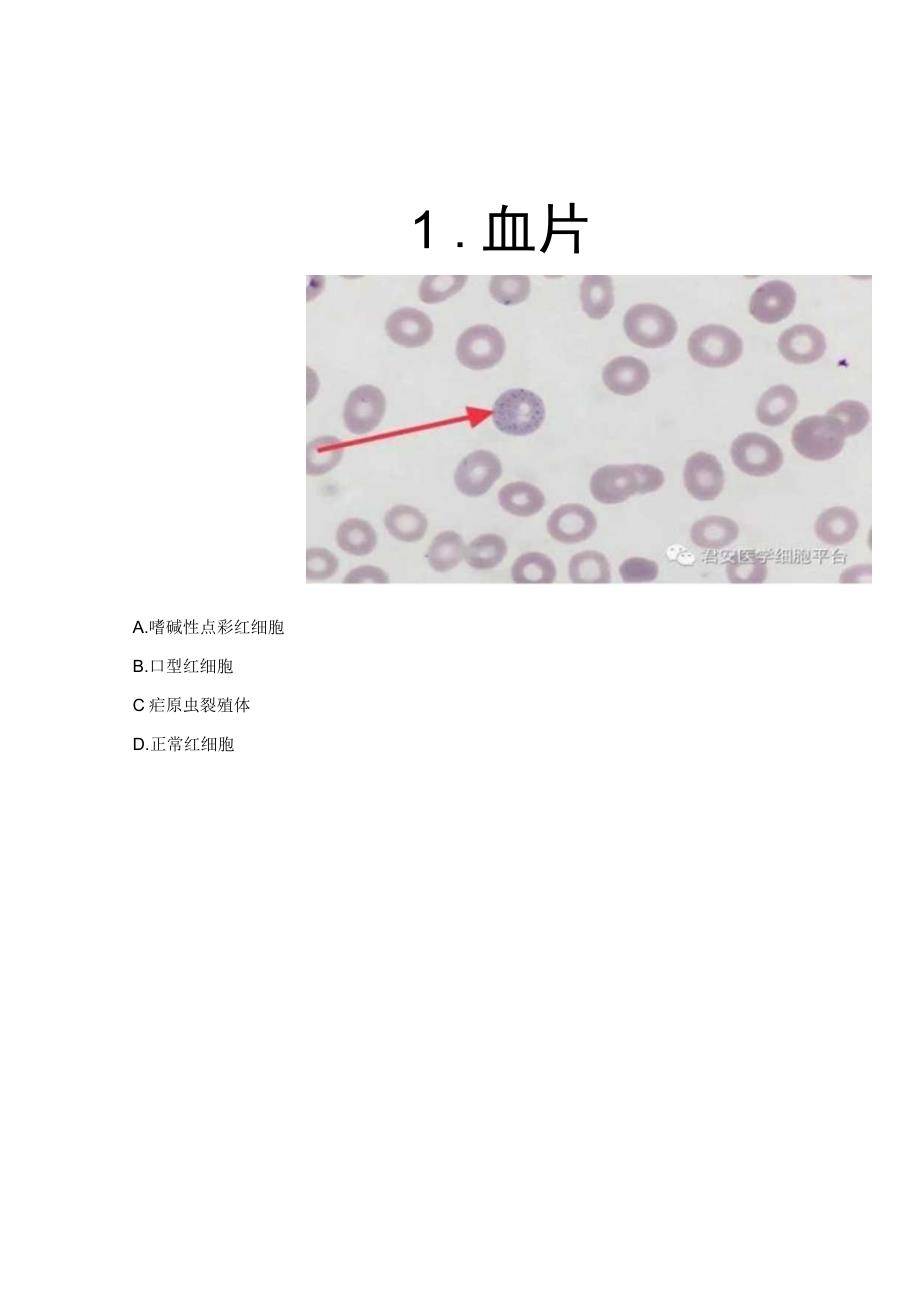 血液及骨髓细胞形态学培训考核试题.docx_第3页