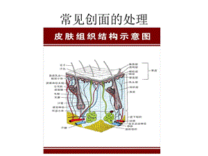 常见创面的处理.ppt