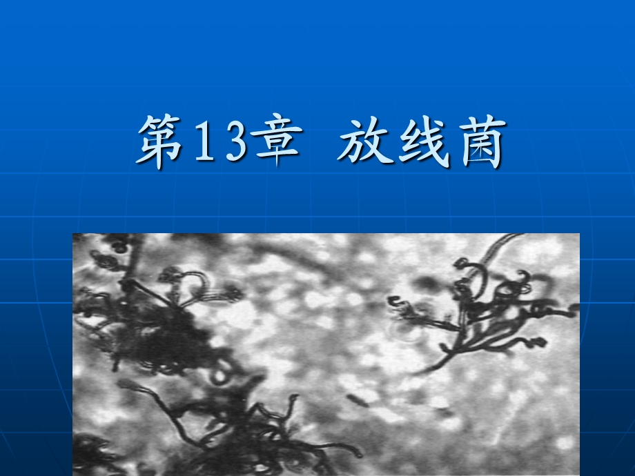 第13章放线菌名师编辑PPT课件.ppt_第1页