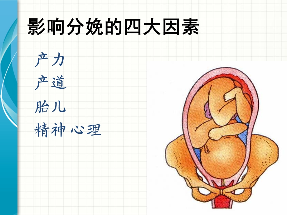 异常分娩(难产.ppt_第2页