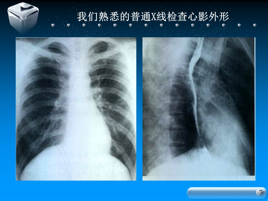 影像核医学在心血管疾病诊断中的应用.ppt_第3页