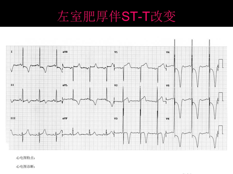 心电图考试完整.ppt_第3页