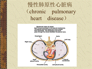 慢性肺原性心脏病名师编辑PPT课件.ppt