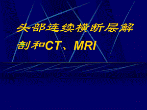 头部连续横断层解剖及CT、MRI名师编辑PPT课件.ppt