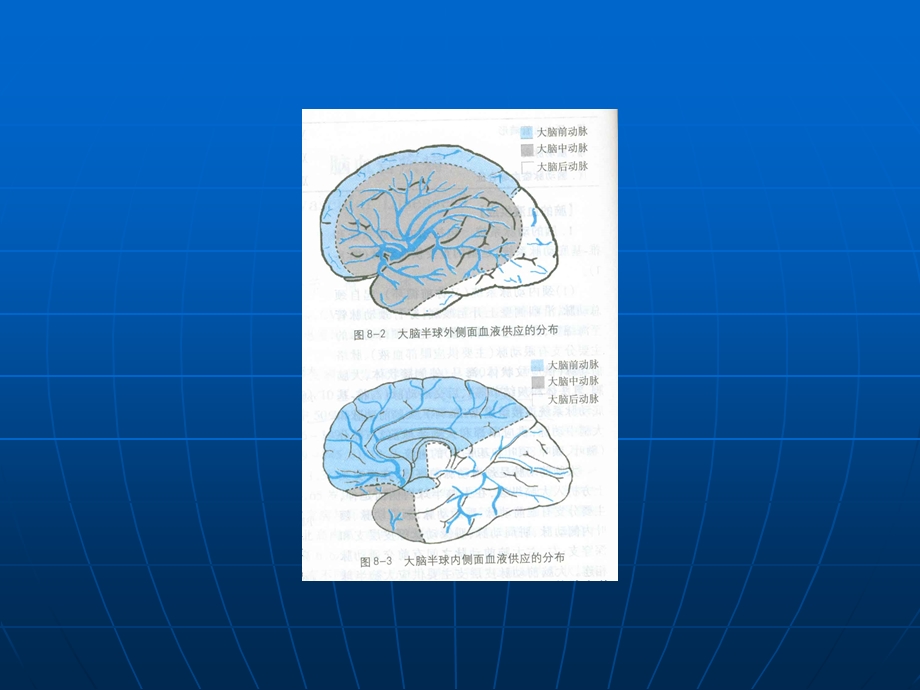 急性脑血管疾病名师编辑PPT课件.ppt_第3页