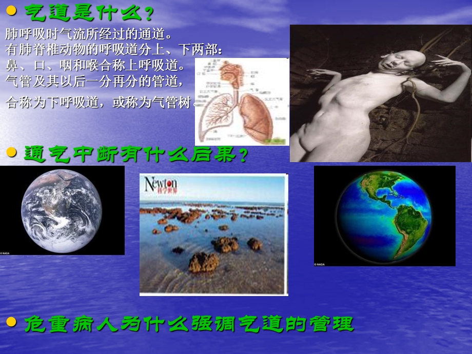 急救中的气道管理.ppt_第2页