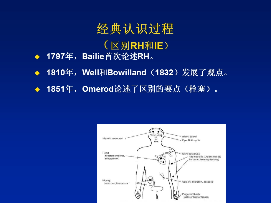 感染心内膜炎名师编辑PPT课件.ppt_第3页