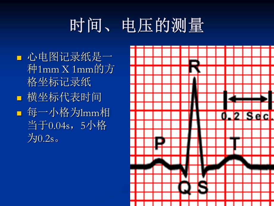 心电图的测量和正常数据.ppt_第2页