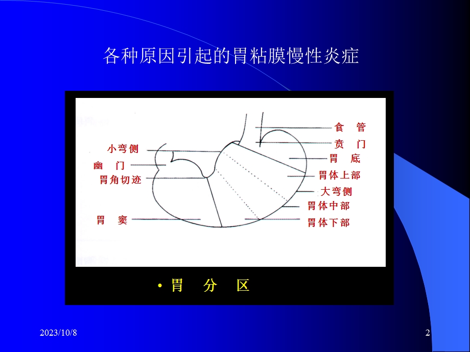 慢性胃炎定稿ppt课件.ppt_第2页