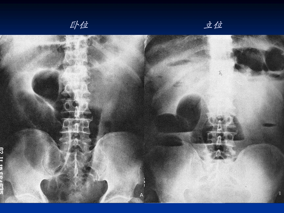 急腹症课件.ppt_第3页