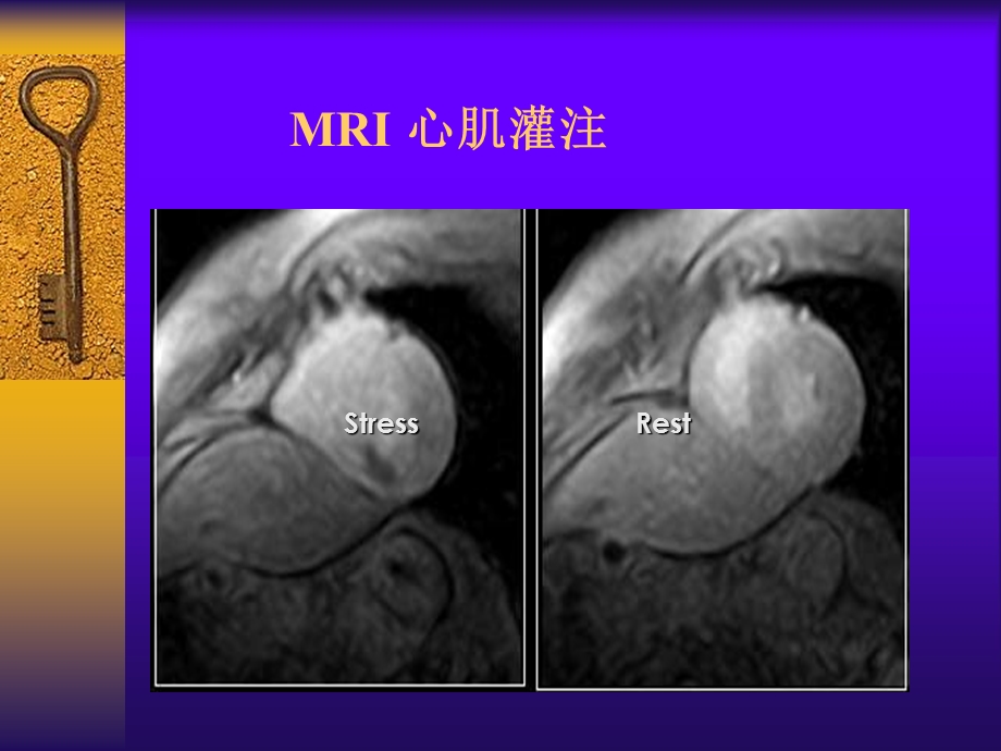 心脏与大血管.ppt_第3页