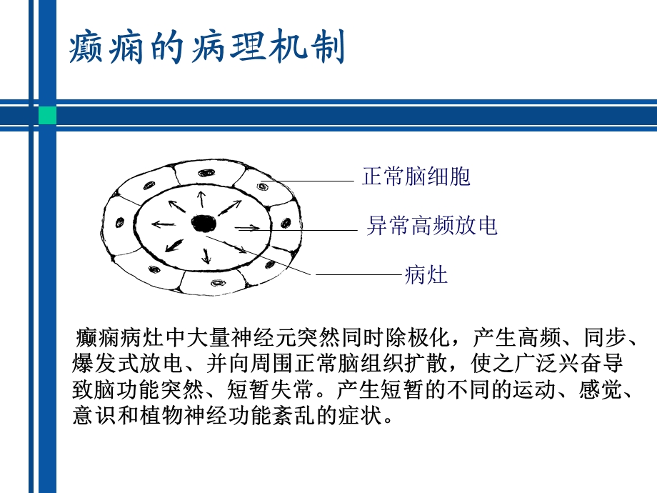 抗癫痫药物介绍.ppt_第3页