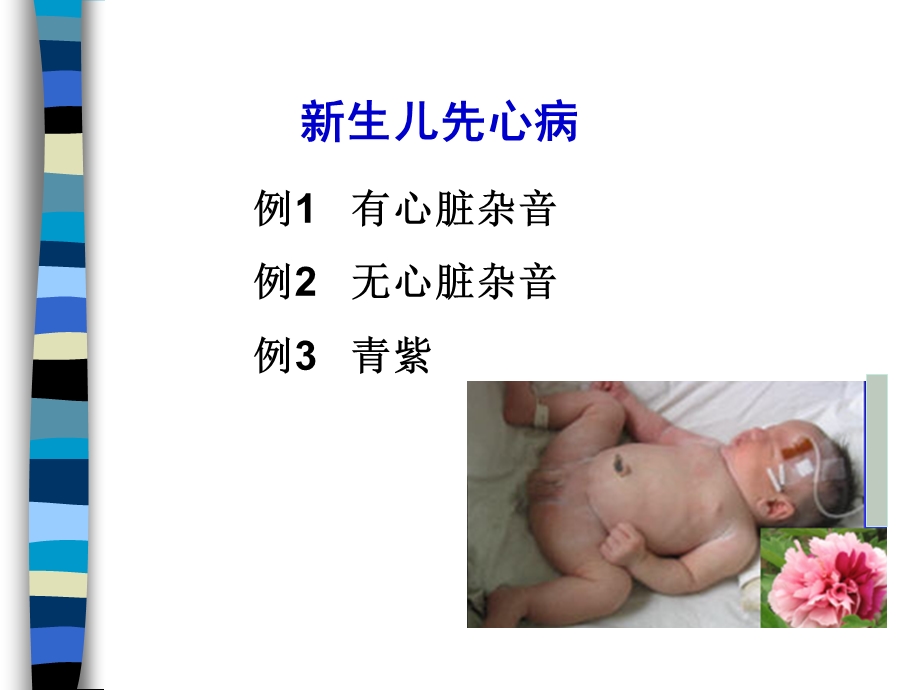 新生儿先天性心脏病名师编辑PPT课件.ppt_第2页