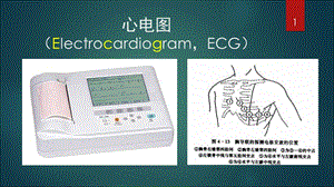 正常心电图.ppt