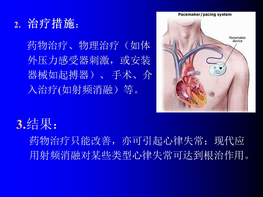 第22章抗心律失常药名师编辑PPT课件.ppt_第3页