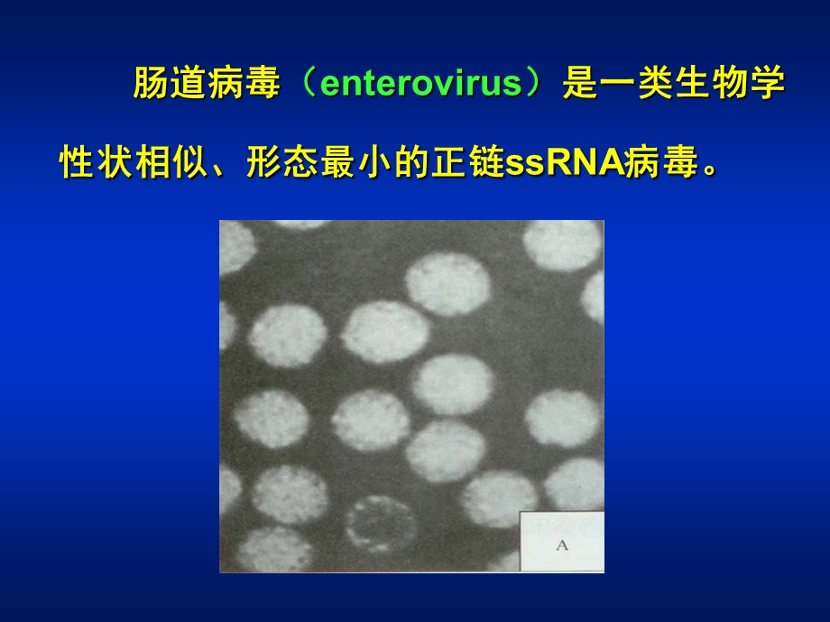 第27章肠道病毒.ppt_第2页