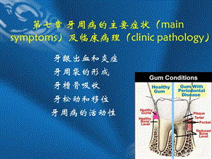 第七章牙周病的主要症状.ppt