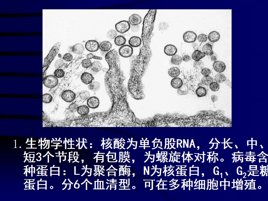 第一节汉坦病毒名师编辑PPT课件.ppt_第3页