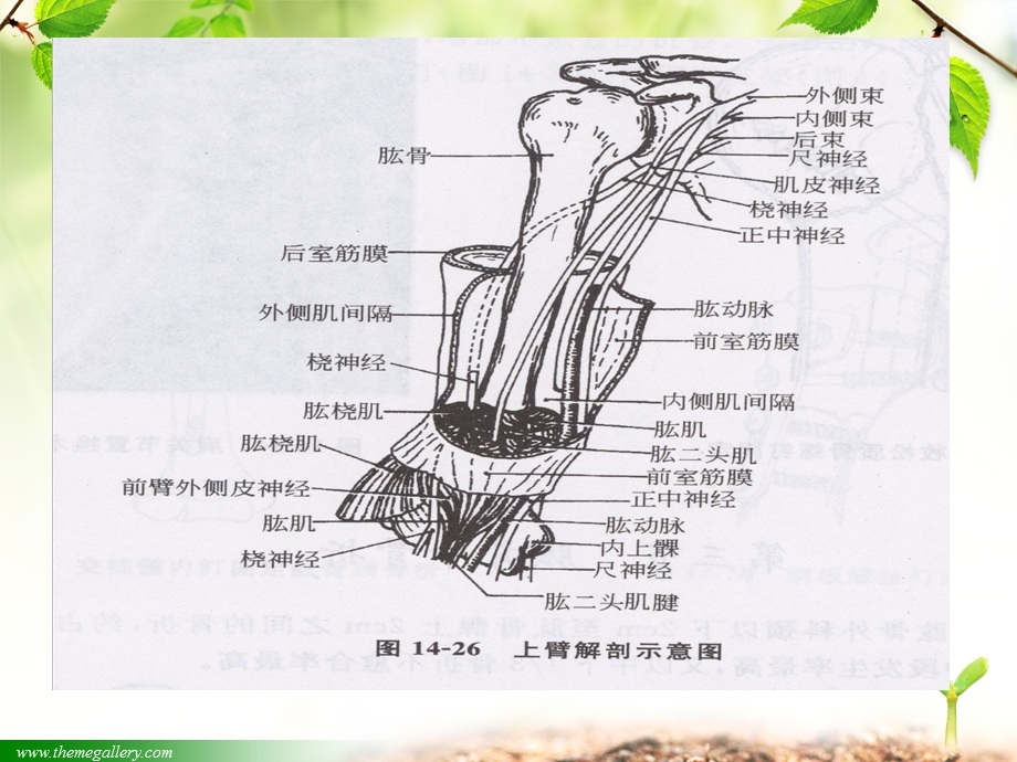 总院肱骨骨折护理查房ppt精简版.ppt_第3页