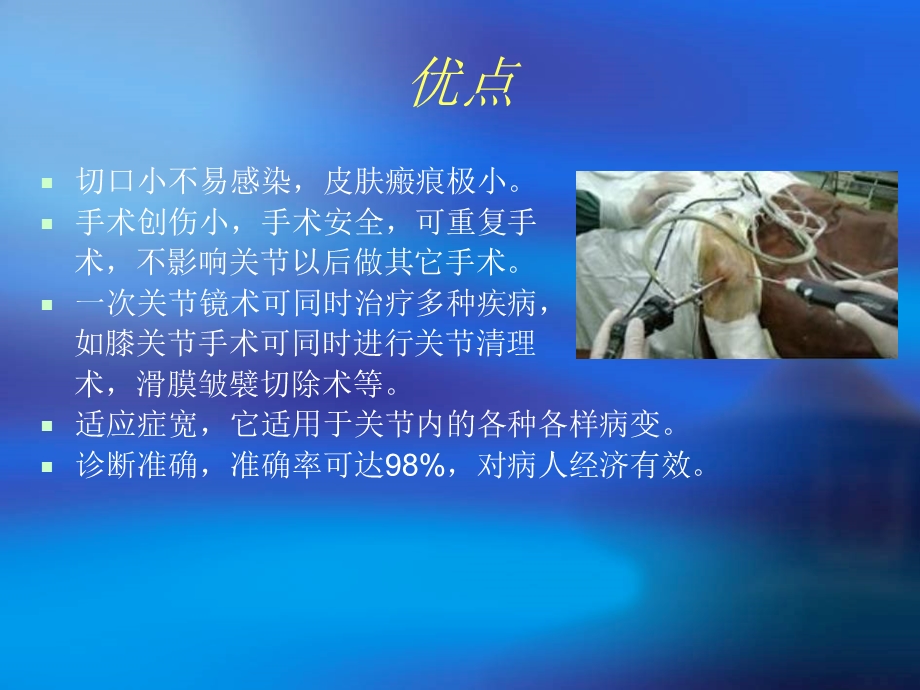 关节镜手术护理幻灯1.ppt_第3页